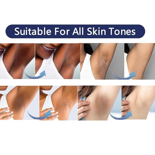 Skin Bleaching Cream